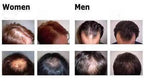Organic Hair Growth Essence--My Store-My Store