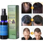 Organic Hair Growth Essence--My Store-My Store